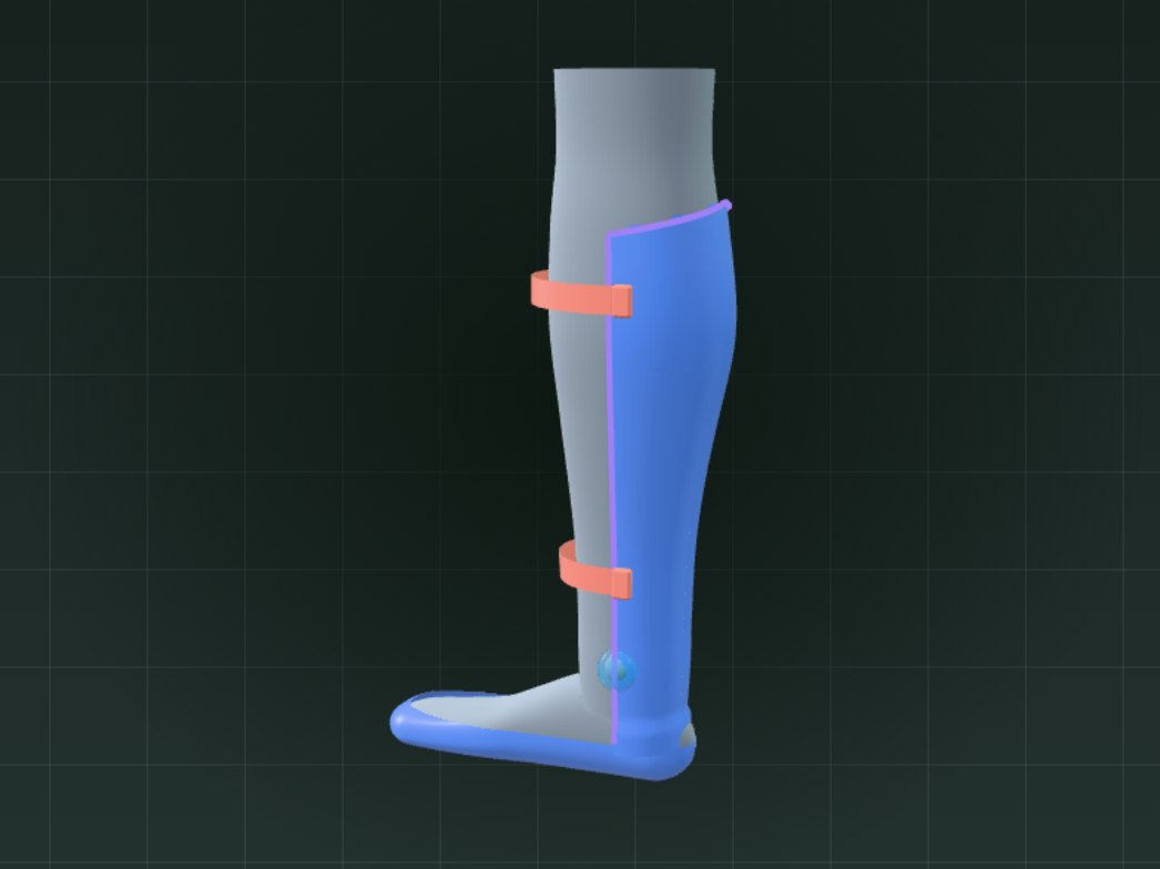 Finished ankle-foot orthosis shell around a leg scan