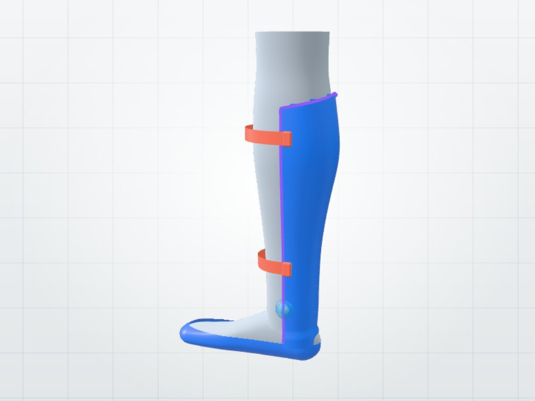 Finished ankle-foot orthosis shell around a leg scan