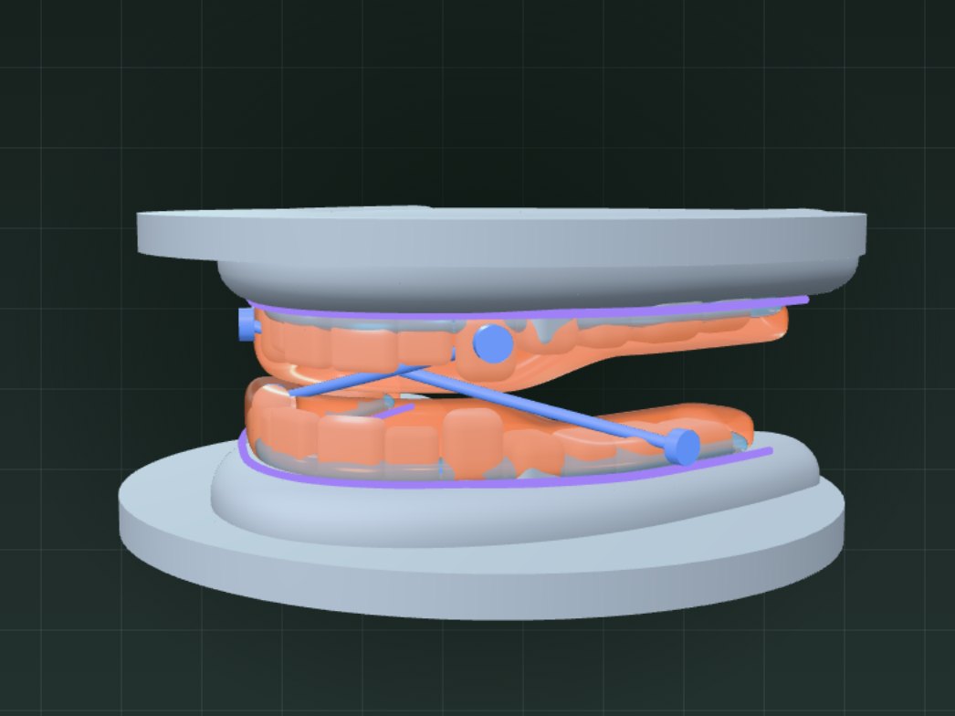 Finished upper and lower sleep appliance splints with strap buttons