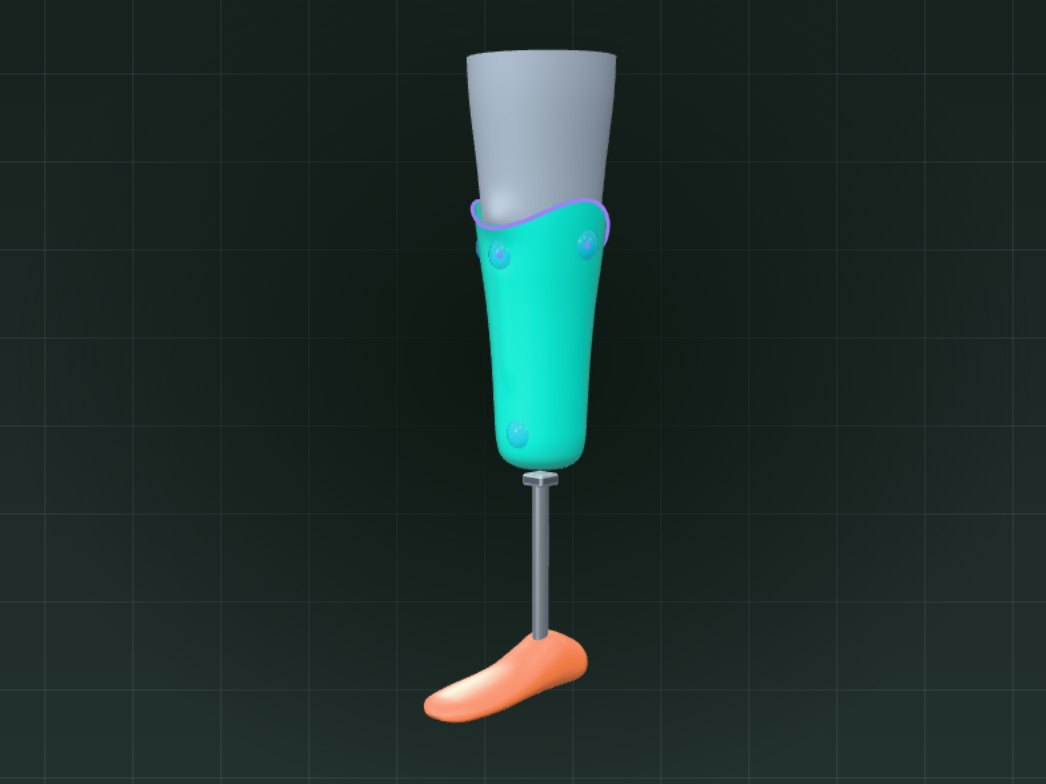 Finished below-knee socket with pylon and foot