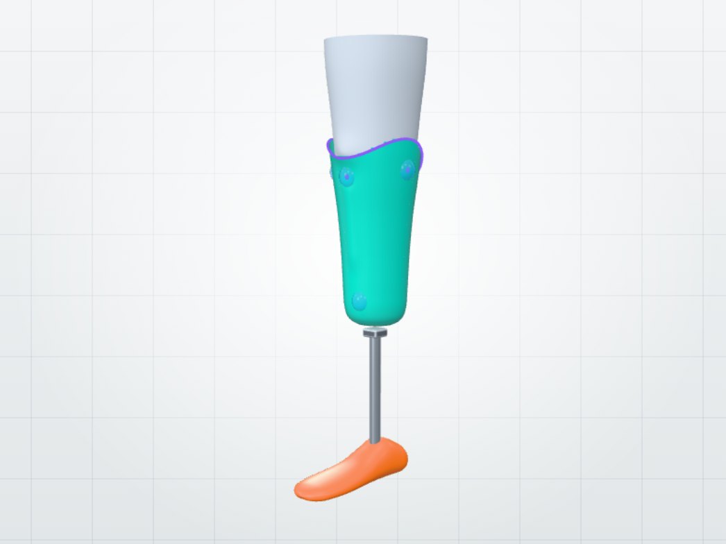 Finished below-knee socket with pylon and foot